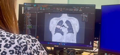 Lung planning